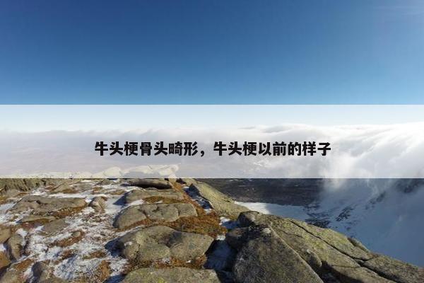 牛头梗骨头畸形，牛头梗以前的样子