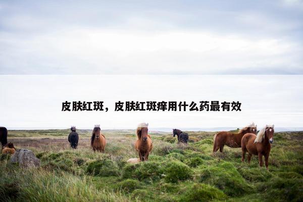 皮肤红斑，皮肤红斑痒用什么药最有效